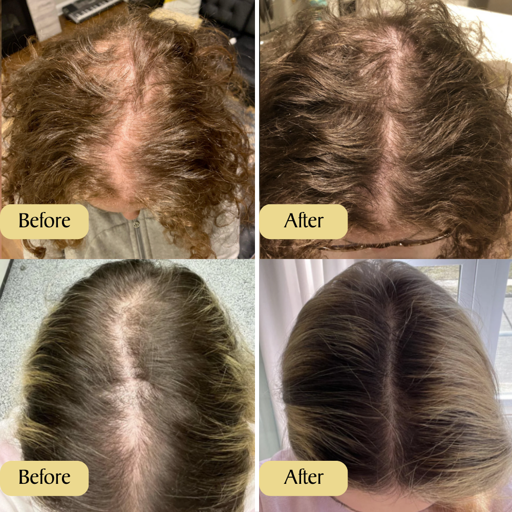 GROWTHE HAARGROEI SERUM