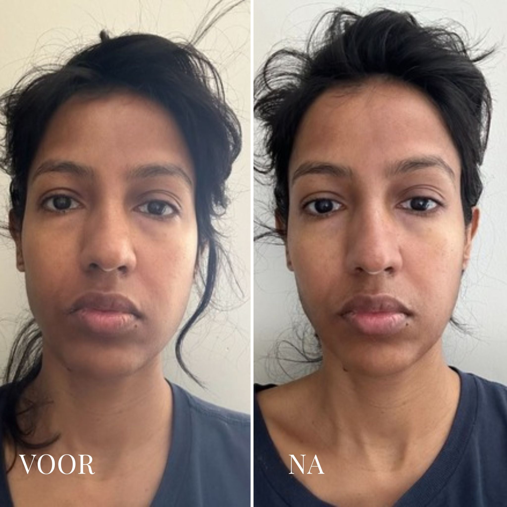 De-Puff Daily IJskoude Gezichtsroller