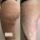 SmoothCurve Anti-Cellulitis Roller