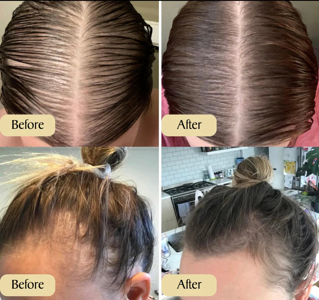 GROWTHE HAARGROEI SERUM